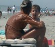 Funny pictures : A Minor Sunburn