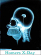 Funny pictures : Homers X-Ray