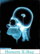 Homers X-Ray