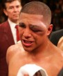 Fernando Vargas Eye