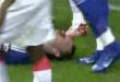 John terry takes boot to the face